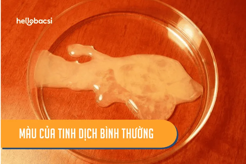 Cách kiểm tra tinh trùng mạnh hay yếu tại nhà